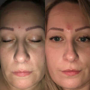Cosmedics Skin Clinics 5 star review on 12th January 2019