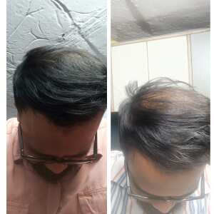 Perfect Hair Health 5 star review on 19th September 2022