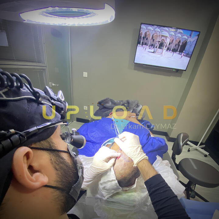 Hair Upload Clinic - Hair Transplant Turkey Istanbul Reviews Best Cost | Sapphire FUE DHI & Dr.Erkam 5 star review on 17th September 2019