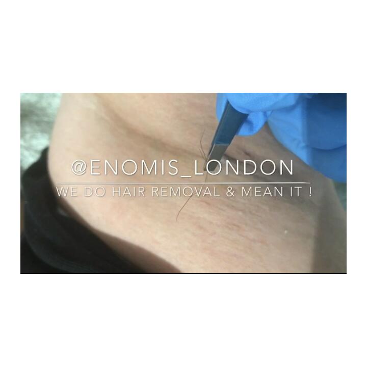 Enomis® London 5 star review on 14th November 2018
