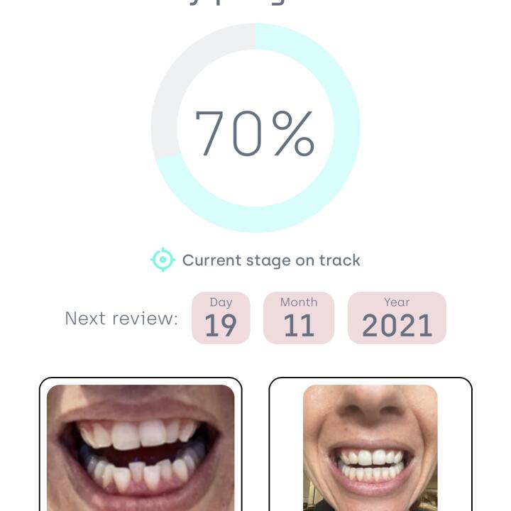 Straight Teeth Direct 5 star review on 3rd November 2021