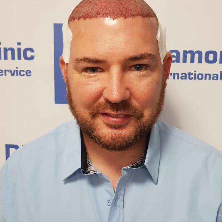Diamond Hair Clinic & Dr. Mehmet Demircioglu - Hair Transplant Turkey Reviews 2024 5 star review on 8th September 2020