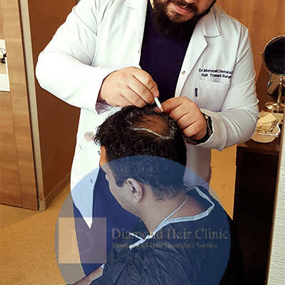 Diamond Hair Clinic & Dr. Mehmet Demircioglu - Hair Transplant Turkey Reviews 2024 5 star review on 12th January 2020