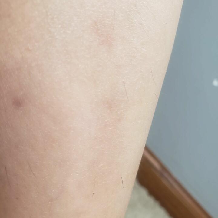 Nood Reviews Read 290 Genuine Customer Reviews